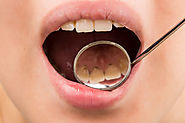 Fundamental Features of Oral Hygienist