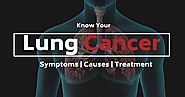 Know your Lung Cancer: Symptoms, Causes and Treatment