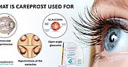 careprost | bimatoprost eye drops | alldaygeneric