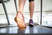 The Common Causes of Heel Pain
