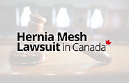 Hernia Mesh Lawsuit - Hernia Mesh