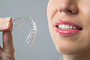 Straighten Your Teeth With Invisalign | Springvale Dental Clinic
