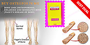 Buy Osteofos 70 mg – Alendronic Acid | Sodium Alendronate | Bone loss | postmenopausal