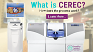 What is CEREC?