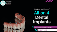 The Pros and Cons of All-on-4 Dental Implants