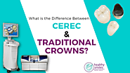Difference Between CEREC and Traditional Dental Crowns
