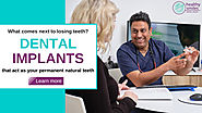 Losing Teeth? Dental Implants Act as Your Permanent Natural Teeth