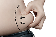 An Overview of the Obalon Balloon Weight Loss Procedure - Dr. Sachin Kukreja Dallas, Fort Worth TX | General & Bariat...