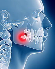 ways suggested by experts to get faster healing after wisdom teeth removal Article - ArticleTed - News and Articles