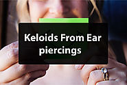 Keloids Caused By Ear Piercings | Sinky Technology
