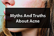Myths And Truths About Acne | Students Look