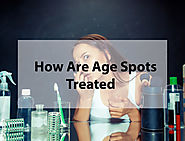 How Are Age Spots Treated | Fashion Boutique