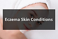 Eczema Skin Conditions | Today Financing