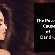 The Possible Causes Of Dandruff | WNS LOGO DESIGNS