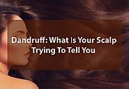 Dandruff: What Is Your Scalp Trying To Tell You? | Exchequer