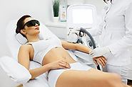 Top 10 Myths about Laser Hair Removal!