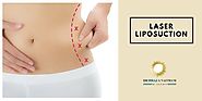 Liposuction Surgery- Know the Procedure and Cost