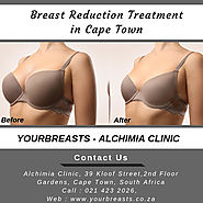 Get the Affordable breast reduction treatment in Cape Town