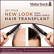 http://www.midastouchcosmetic.com/web/page/hair-transplant