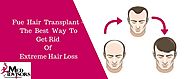 Fue Hair Transplant – The Best Way To Get Rid Of Extreme Hair Loss