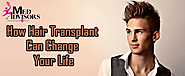 How Hair Transplant Can Change Your Life — Med Advisors