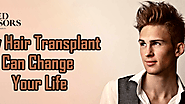 How Hair Transplant Can Change Your Life - Med Advisors