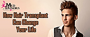 How Hair Transplant Can Change Your Life | Med Advisors