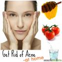Simple Yet Effective Ways To Get Rid Of Acne