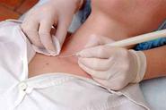 Skin Tag Extraction: Three Trained Medical Practitioners