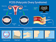 PCOD Problem Treatment in Bangalore, India | Polycystic Ovarian Disease