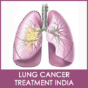 Get Lung Cancer Treatment in India at Affordable Prices
