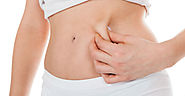 Website at https://www.skncosmetics.com/blog/how-liposuction-improves-the-shape-of-face-and-belly/