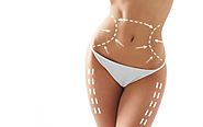 Website at https://www.skncosmetics.com/blog/10-unknown-myths-about-liposuction/