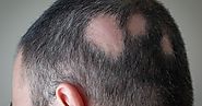 Independent Escorts Melbourne - Males Who Stopped Ingesting Anti-Baldness Drug Noted Lowering of Sex Drive