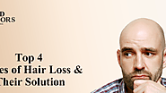 Top 4 Causes of Hair Loss and Their Solution | Med Advisors