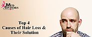 Top 4 Causes of Hair Loss and Their Solution | Med Advisors