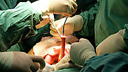 Colorectal surgery - Gastro Surgeon Kochi | Gastroenterologist In Kerala