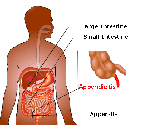 Appendicitis - Gastro Surgeon Kochi | Gastroenterologist In Kerala