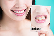 Website at https://www.allsmilesdc.org/instant-teeth-whitening