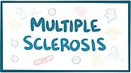 Ways CBD Can Help with Multiple Sclerosis!