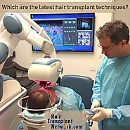 Modern Hair Transplant Techniques