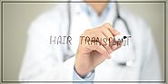 Hair transplantation in 2018 and the most prominent used techniques