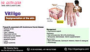 Dr. Geeta Gera, skin disease doctor, best Dermatologists in Indirapuram,