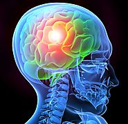 How Can A Brain Injury Attorney Help In Miami?