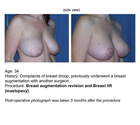 breast surgeons are important to vet