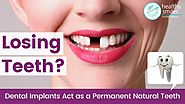 Losing Teeth? Dental Implants Act as a Permanent Natural Teeth