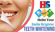 Teeth Whitening Can Resolve Deep Stains and Discoloration