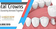 Getting a Dental Crowns on Your Teeth