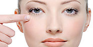 dark circles under eyes - Laser Skin Care Treatment