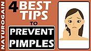 4 Best Healthy Tips to Prevent Pimples, Avoid Breakouts QUICKLY